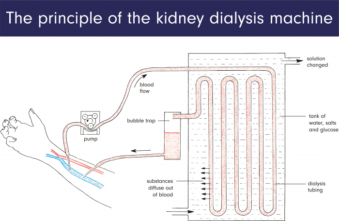 A dialysis machine